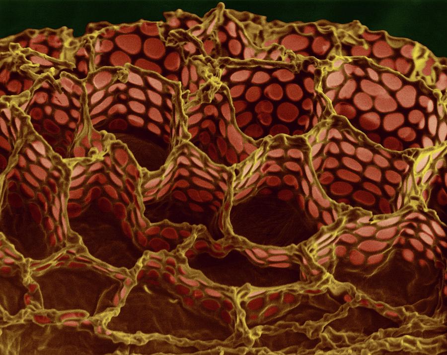 Plants Photograph - Foxglove Seed Surface (digitalis Purpurea) by Dennis Kunkel Microscopy/science Photo Library