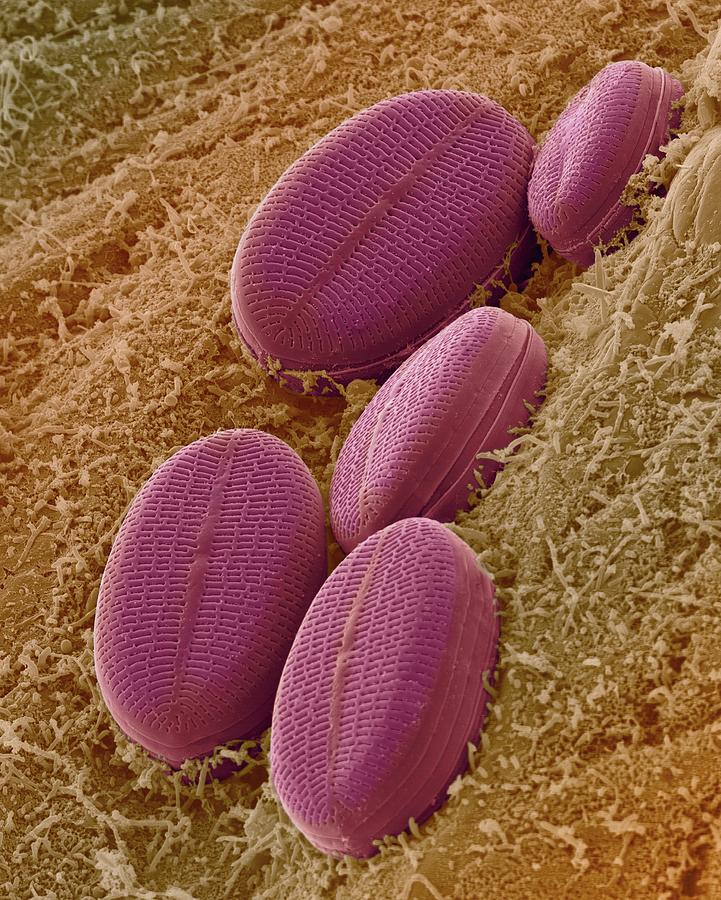 Fresh Water Pennate Diatom Photograph by Dennis Kunkel Microscopy/science Photo Library