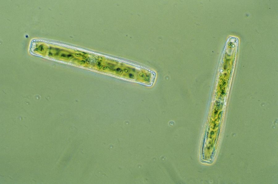 Fresh Water Pennate Diatom (hantzschia Sp.) Photograph by Dennis Kunkel Microscopy/science Photo Library