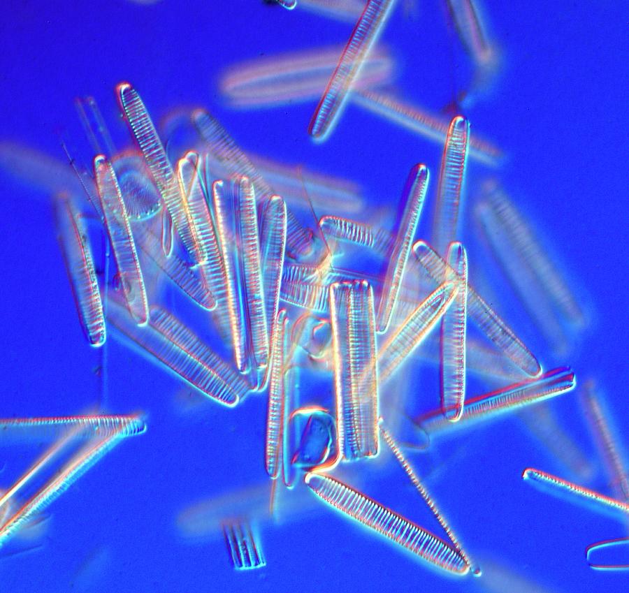 Fresh Water Pennate Diatoms Photograph by Alfred Pasieka/science Photo Library