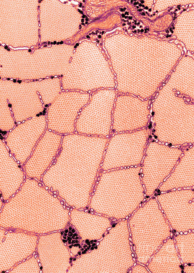 Frog Muscle, Tem Photograph by Omikron