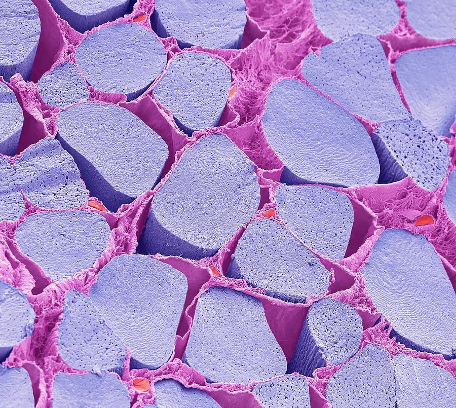 Frog Skeletal Muscle Fibres Photograph by Steve Gschmeissner/science Photo Library