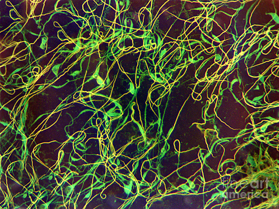 Frog Spermatozoa Photograph by Garry DeLong