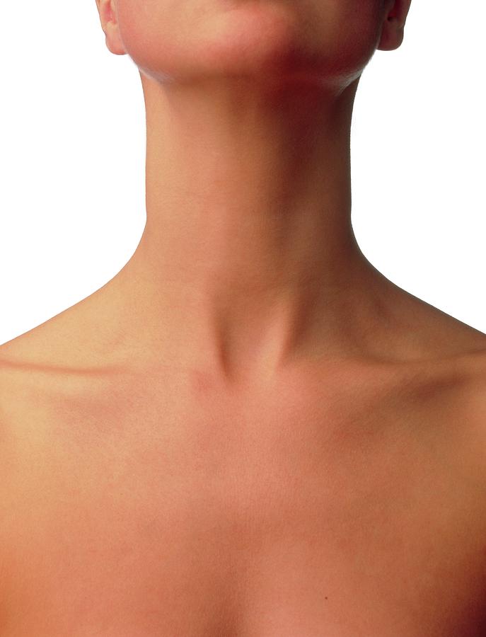 Front View Of The Neck And Upper Chest Of A Woman by Phil Jude/science  Photo Library