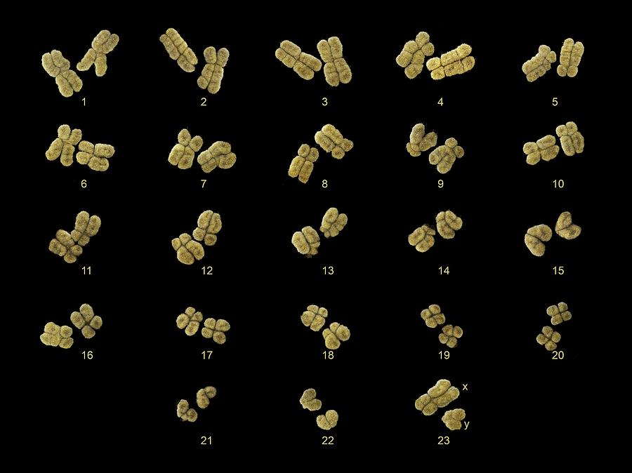 23 Pairs Photograph - Full Set Of Male Chromosomes, Sem by Power And Syred