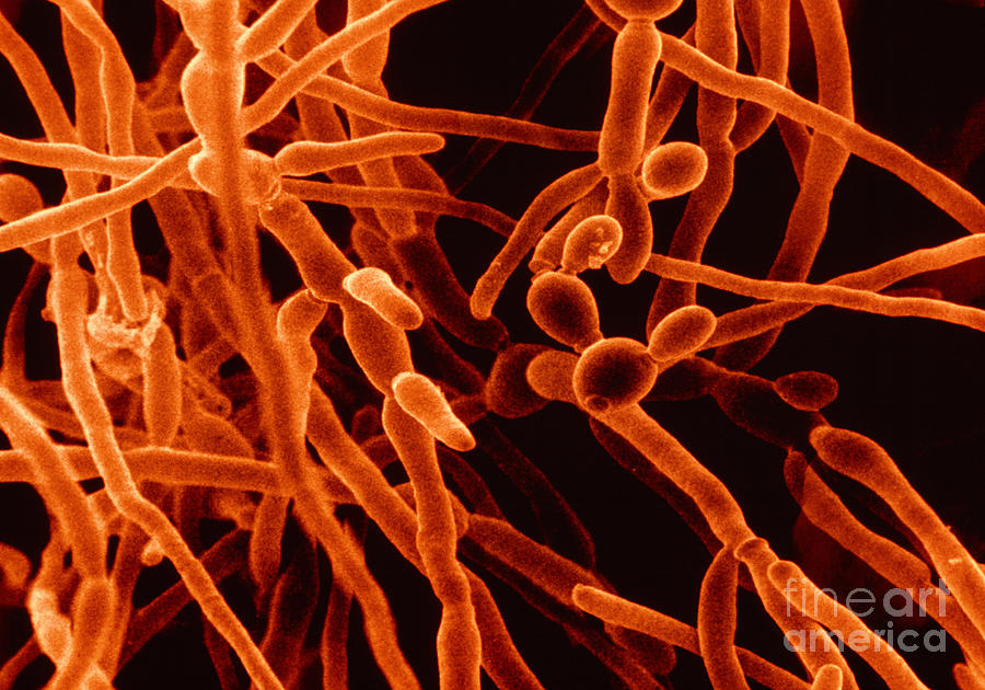 Fungus, Candida Albicans, Sem Photograph by David M. Phillips