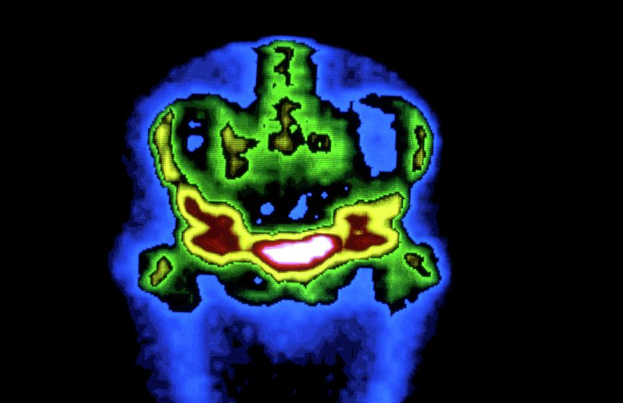 Skeleton Photograph - Gamma Scan Of Human Pelvis by Cnri/science Photo Library