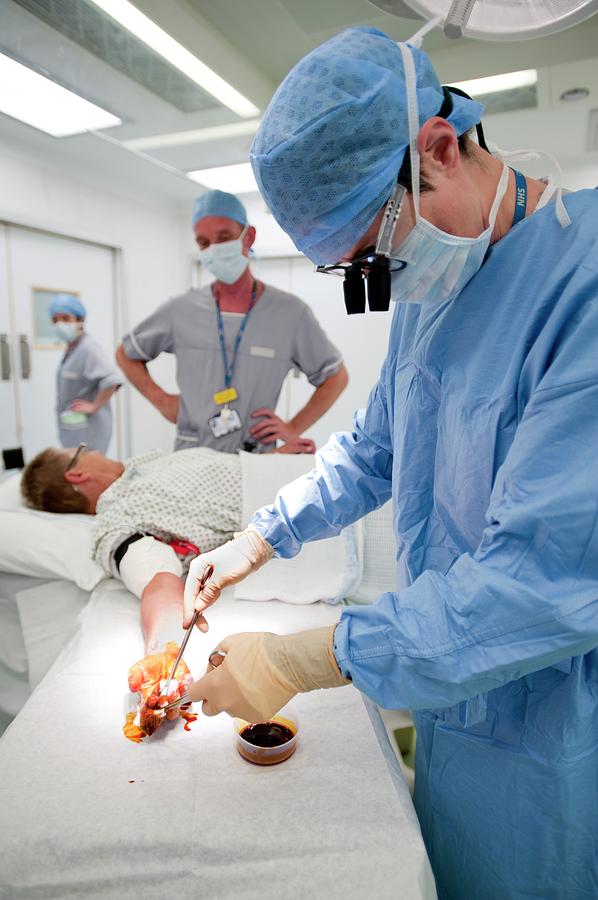 Ganglion Removal Surgery Photograph By Jim Varney Science Photo Library Fine Art America