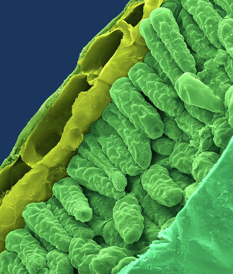 Gardenia Leaf Cross Section (gardenia Sp.) Photograph by Dennis Kunkel ...