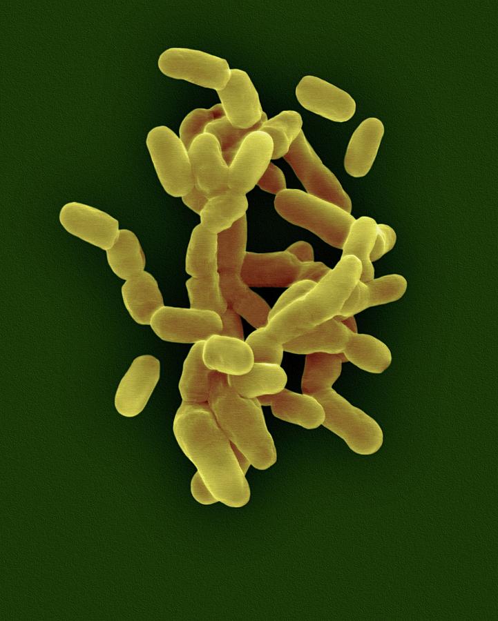 Gardnerella Vaginalis Photograph by Dennis Kunkel Microscopy/science Photo Library