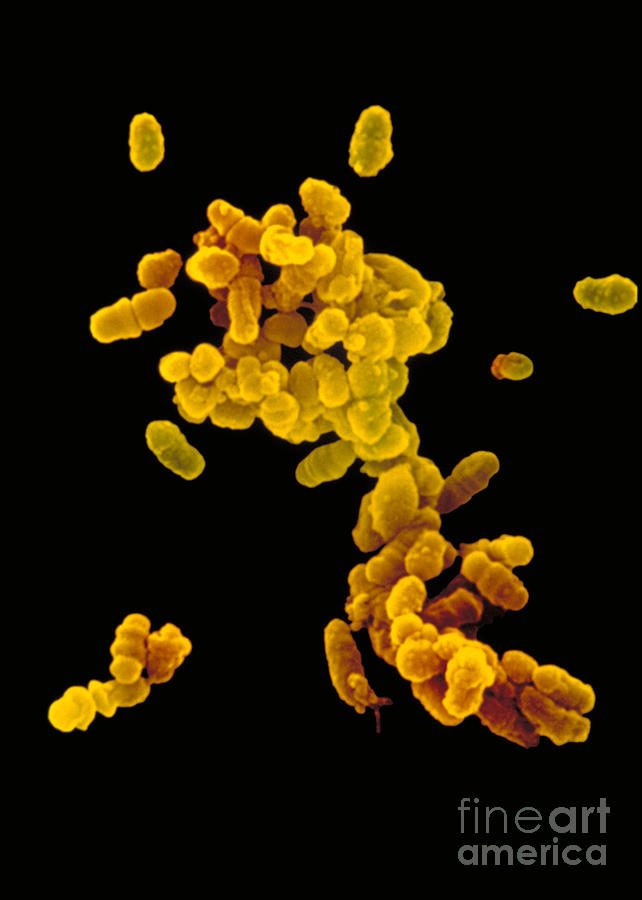 Bacteria Photograph - Gardnerella Vaginalis by Stem Jems