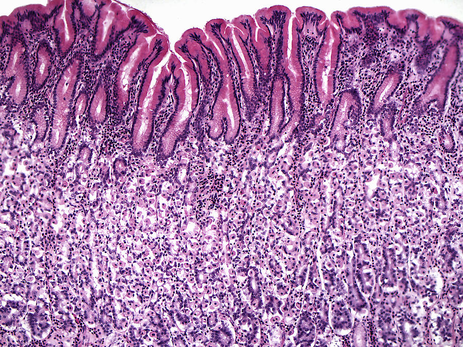 Stomach Photograph - Gastric Mucosa, Lm by Alvin Telser