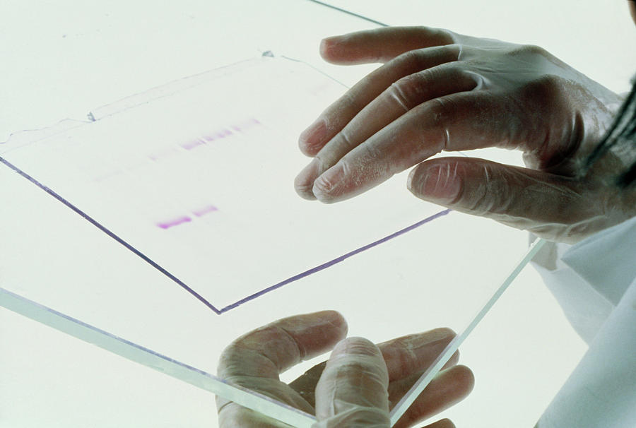 Gel With Dna Fragments After Electrophoresis Photograph by National Cancer Institute/science Photo Library