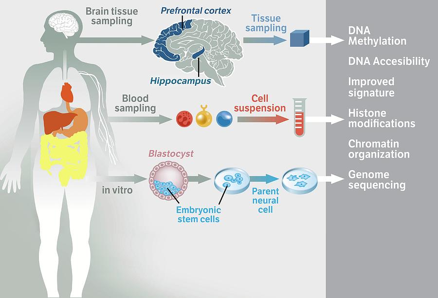 scid treatment gene therapy