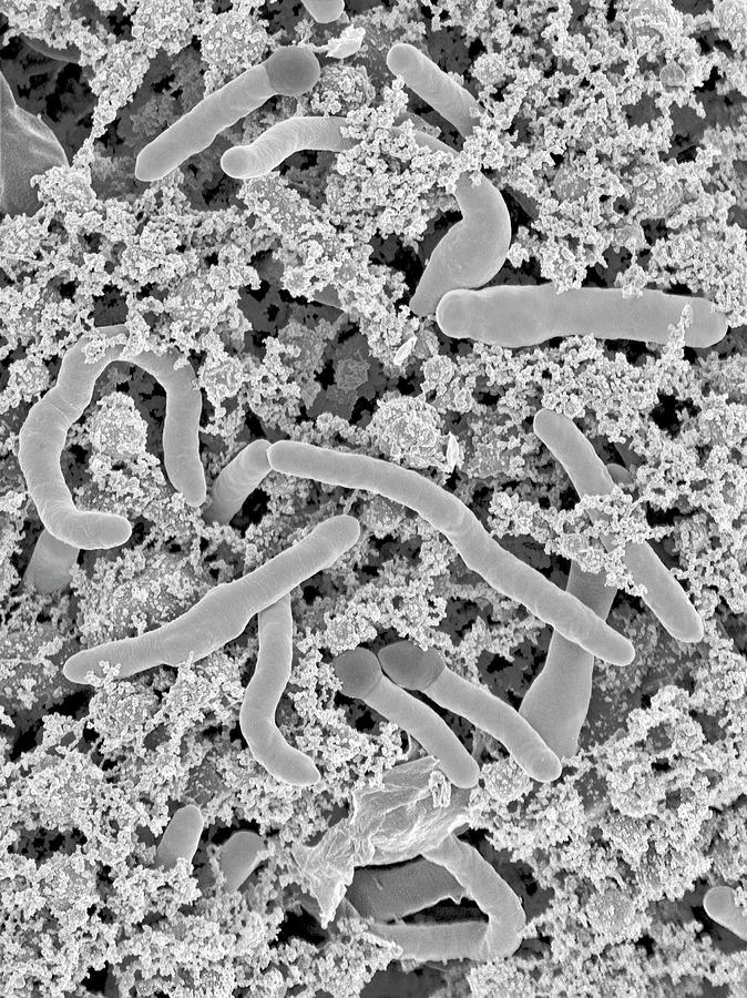 bacillus stearothermophilus gram stain