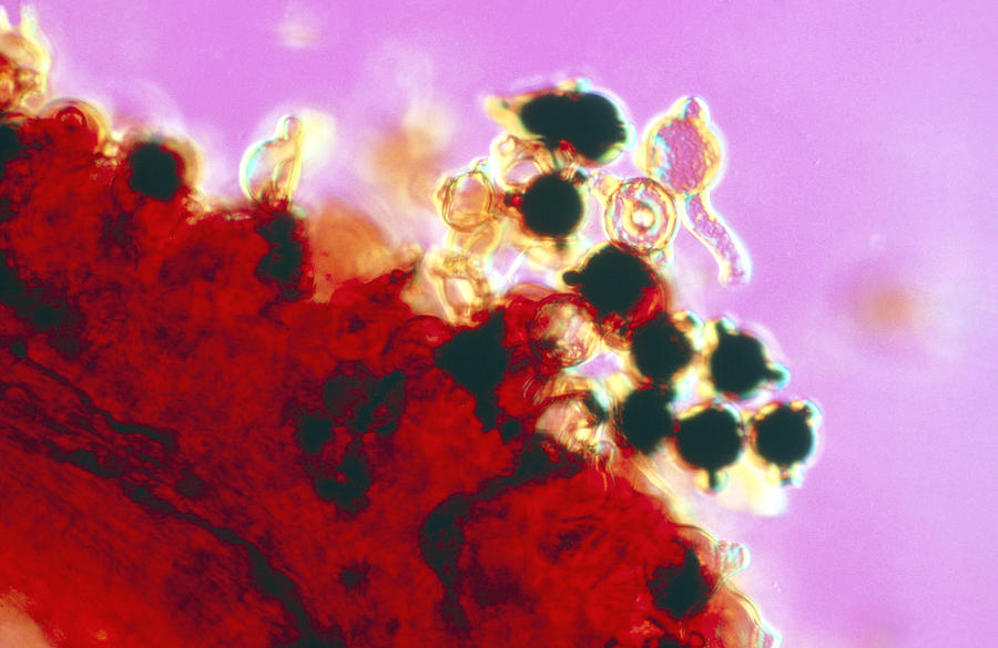 Epilobium Photograph - Germinating Pollen Grains by Perennou Nuridsany