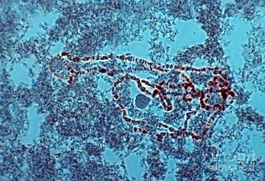Giant Chromosomes From Fruit Fly Photograph by Joseph F. Gennaro Jr.