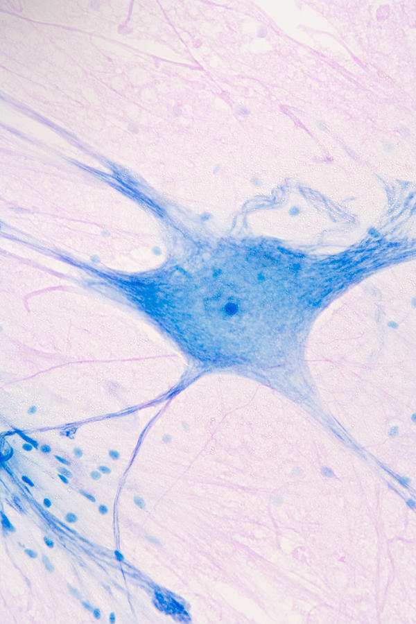 Giant Multipolar Neuron And Glial Photograph by Science Stock Photography