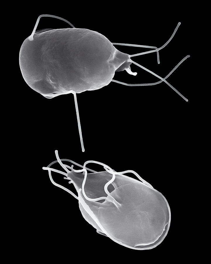 Black And White Photograph - Giardia Lamblia Parasitic Protozoan by Dennis Kunkel Microscopy/science Photo Library