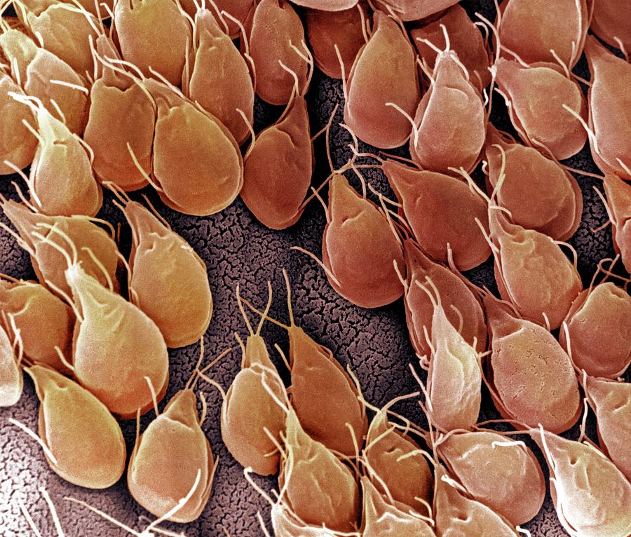 Giardia Lamblia Protozoan Photograph By Ami Images Science Photo