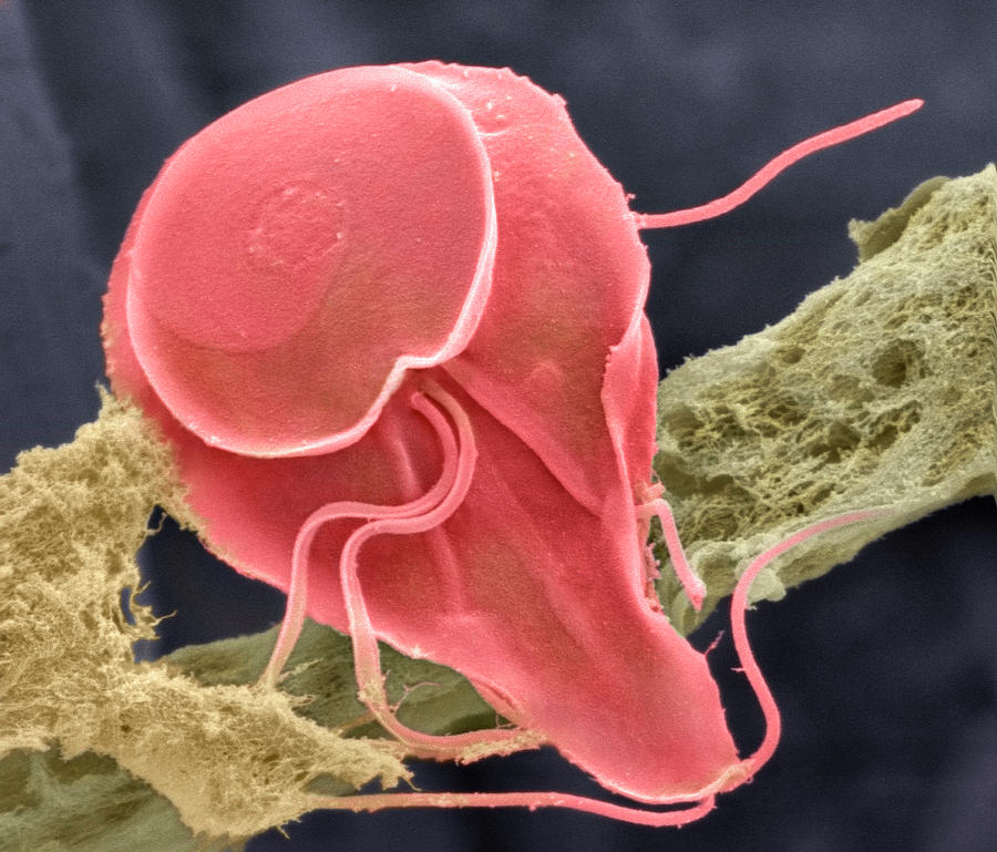 Giardia Lamblia Protozoan Photograph By Dr Tony Brainscience Photo Library Pixels 6303