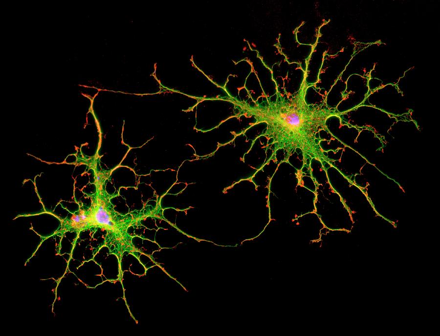 Glial Cells Photograph by Dr Jan Schmoranzer/science Photo Library