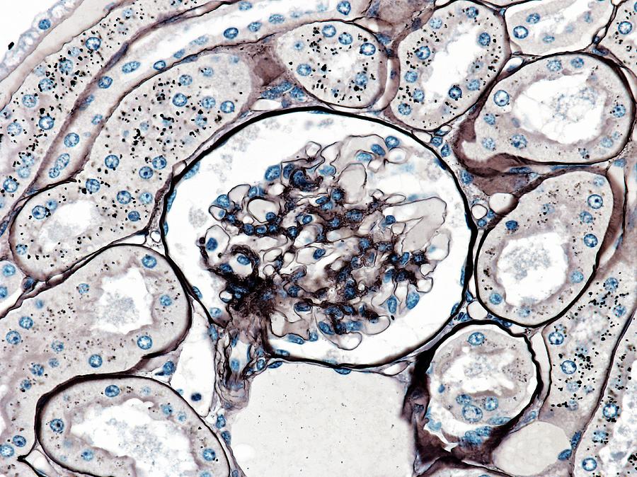 Glomerulus Photograph by Microscape