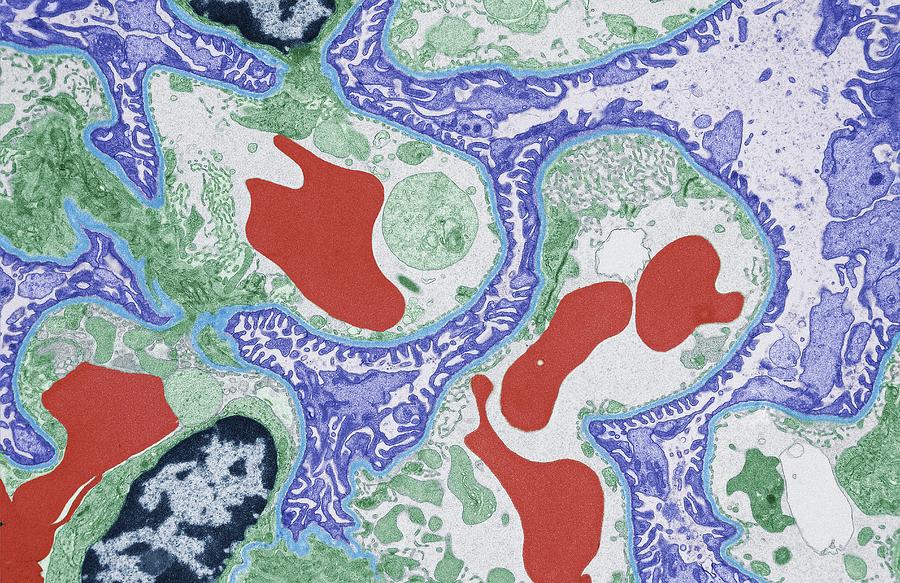 Glomerulus Photograph by Steve Gschmeissner/science Photo Library