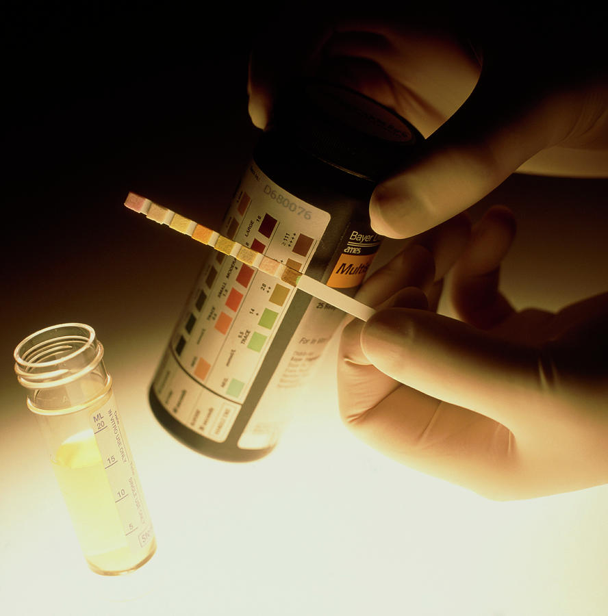 Gloved Hand Holding Urine Sample Test Stick Photograph By Saturn Stillsscience Photo Library