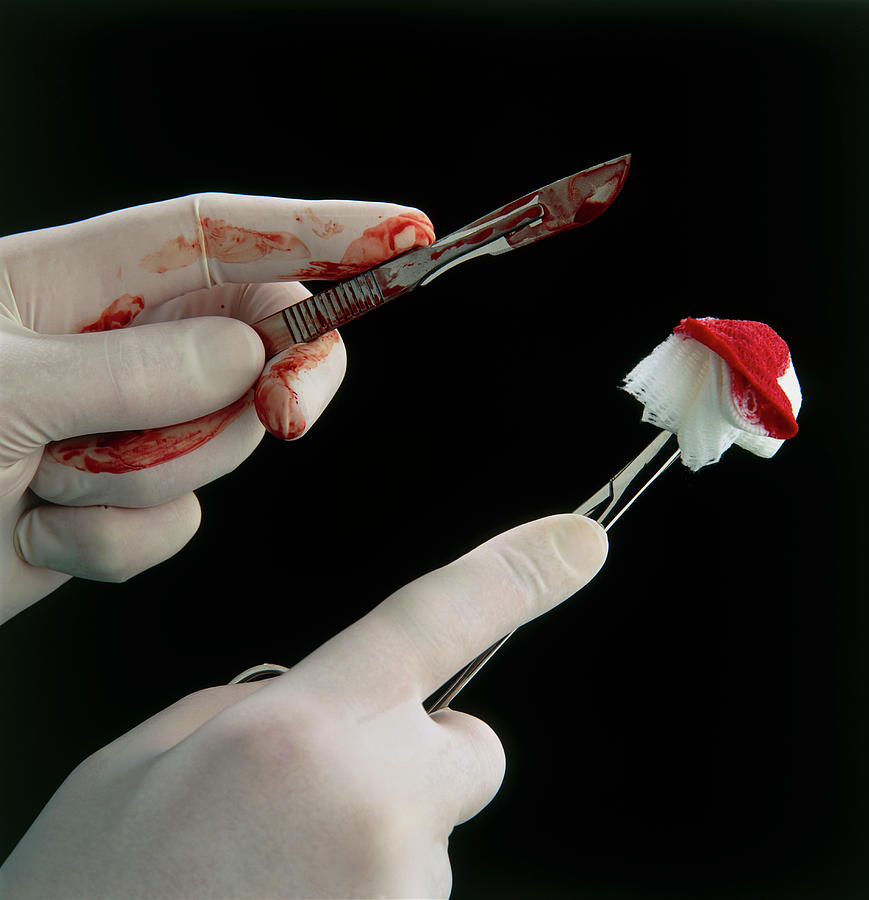 Gloved Hands With Bloody Scalpel And Gauze Photograph by Saturn Stills/science Photo Library