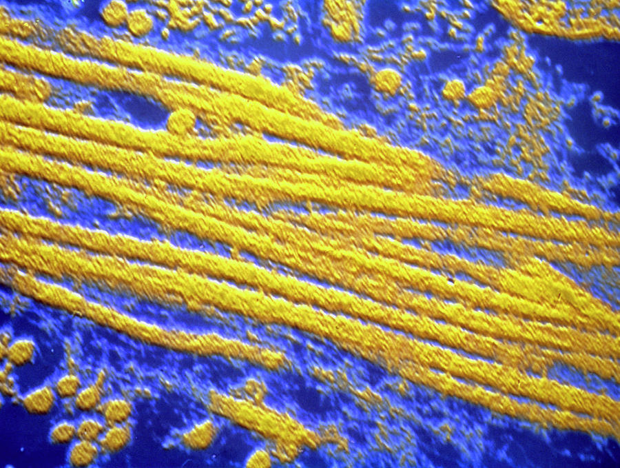 Glycoprotein Filaments In Mucus Photograph by Cnri/science Photo Library