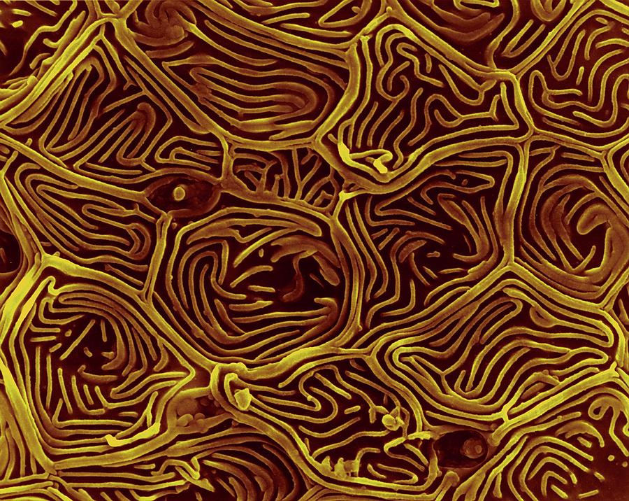 Fish Photograph - Goldfish Skin by Dennis Kunkel Microscopy/science Photo Library