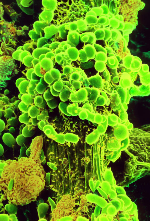 Green Alga Photograph by Microfield Scientific Ltd/science Photo Library