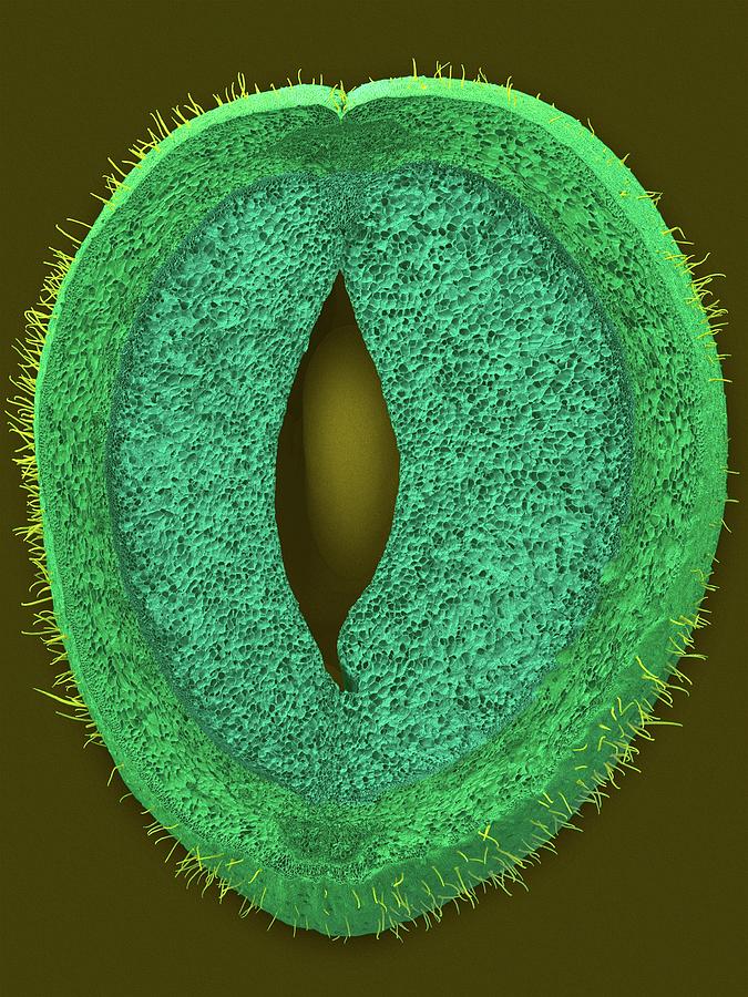 Green Bean Parenchyma Cells And Seed Photograph by Dennis Kunkel Microscopy/science Photo Library