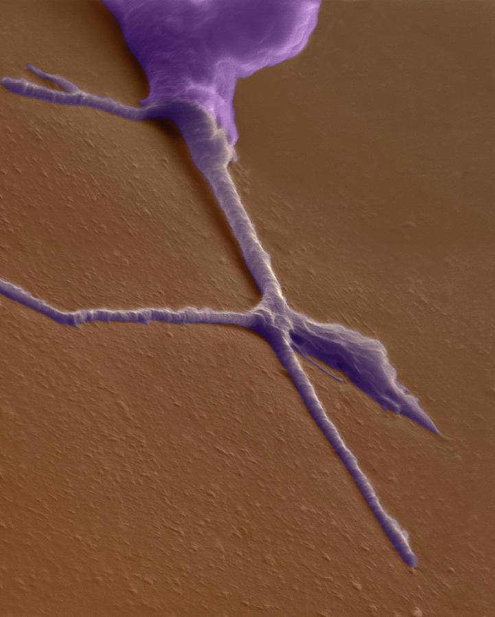Growth Cone From A Developing Neuron Photograph by Dennis Kunkel Microscopy/science Photo Library