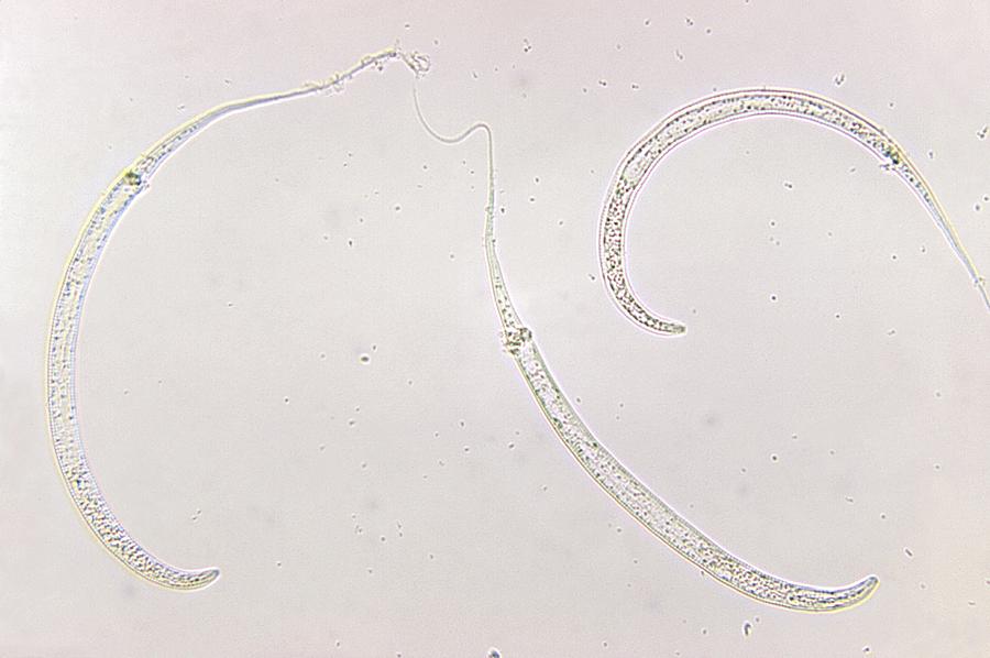 Guinea Worm Larvae Photograph by Science Photo Library - Pixels