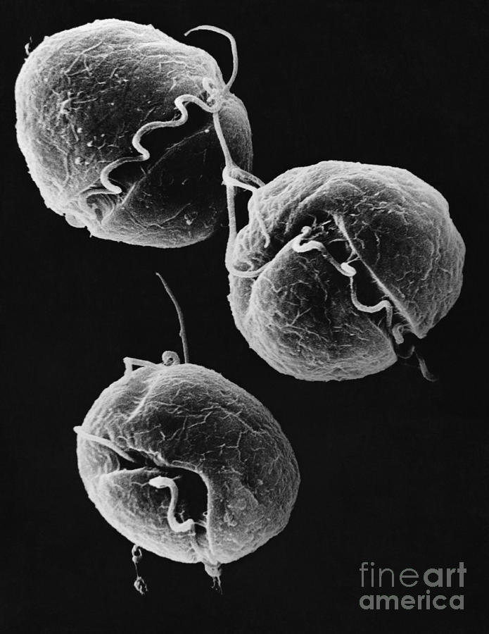 Gyrodinium Dinoflagellates Photograph by David M. Phillips