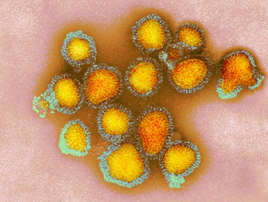 H3N2 influenza virus particles, TEM Photograph by Cdc/science Photo Library