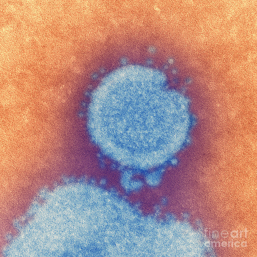H7n9 Influenza Virus Photograph by Science Source