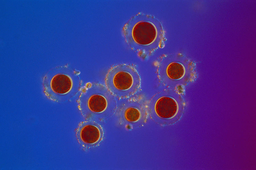 Haematococcus Sp. Green Algae, Lm Photograph by Michael Abbey