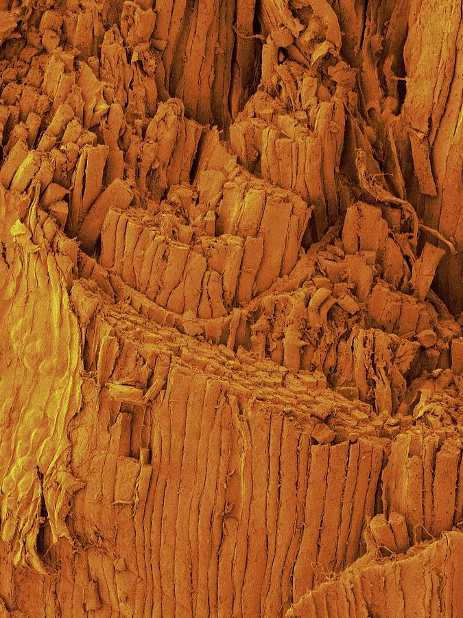 Ham Shank Muscle Fibres Photograph by Dennis Kunkel Microscopy/science Photo Library