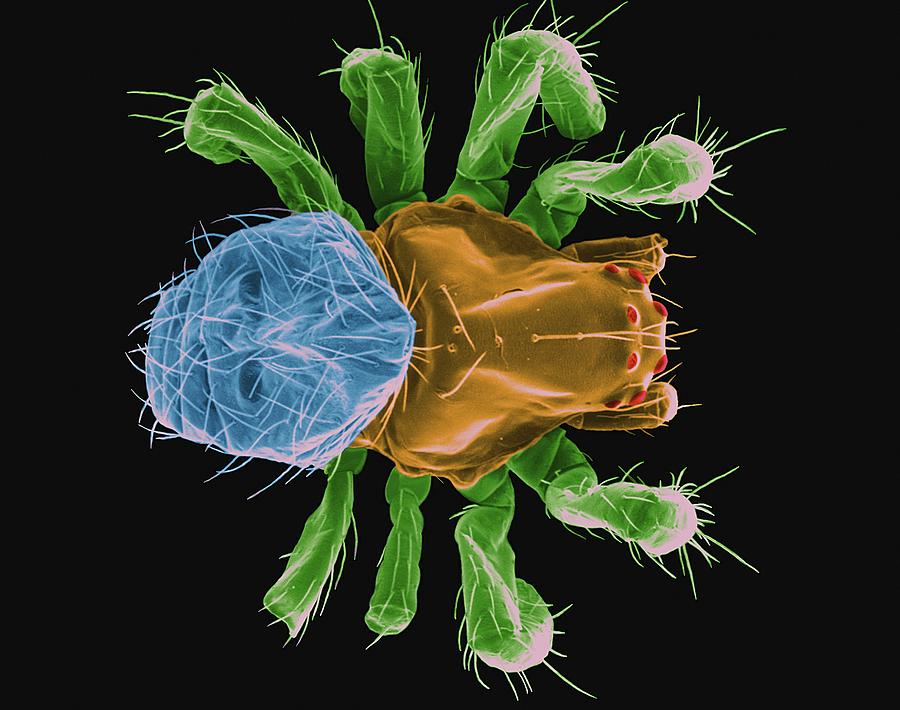 Hammock Spider (pityohyphantes Costatus) Photograph by Dennis Kunkel Microscopy/science Photo Library
