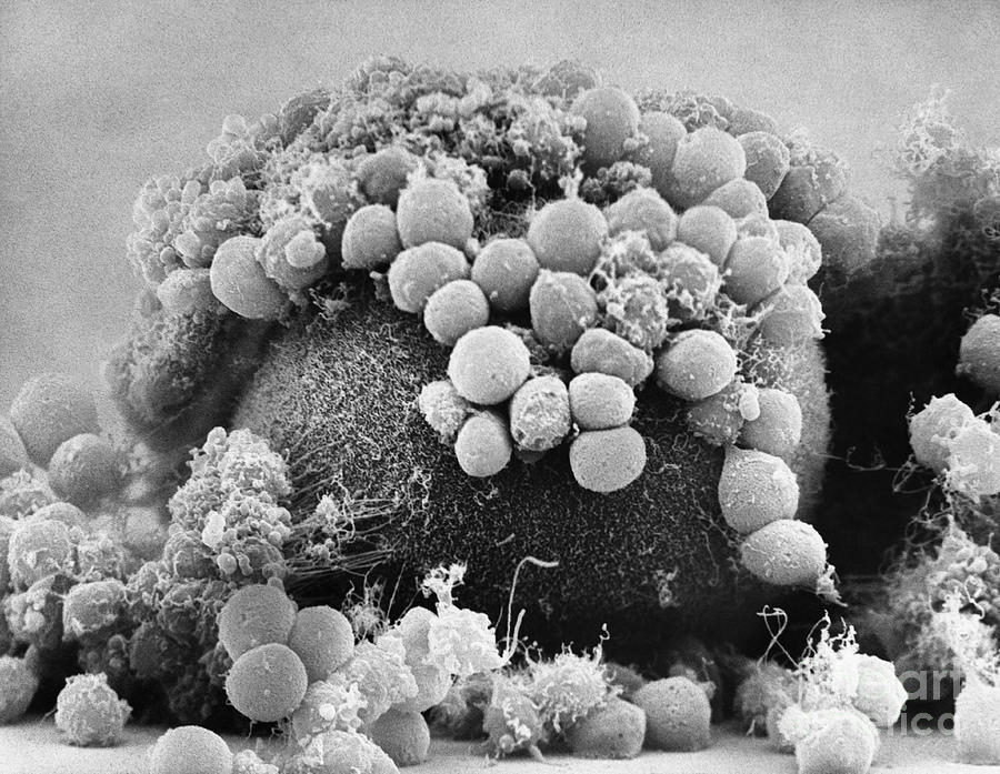 Hamster Egg And Cumulus Cells Sem Photograph by David M. Phillips
