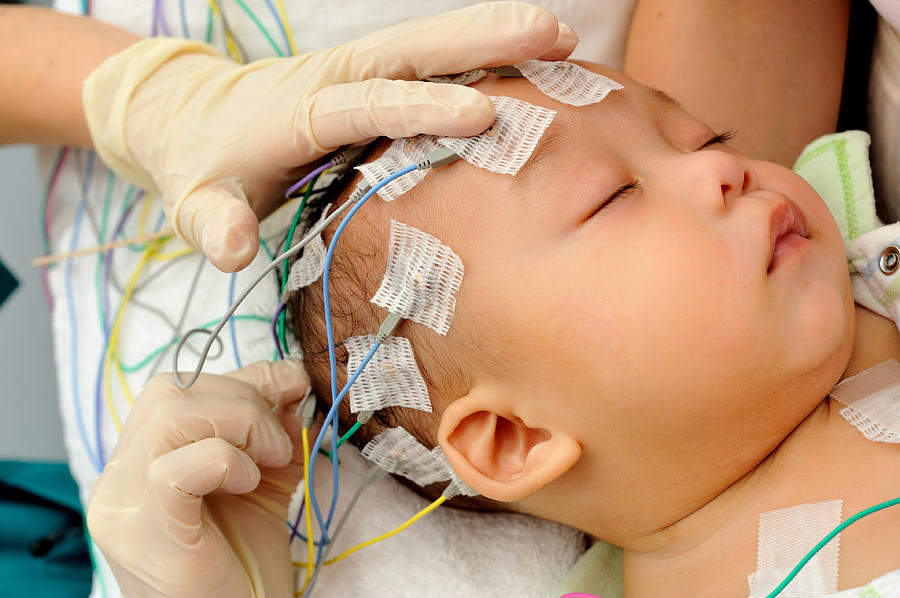Hands applying electrodes to baby for electroencephalography Photograph by Dblight