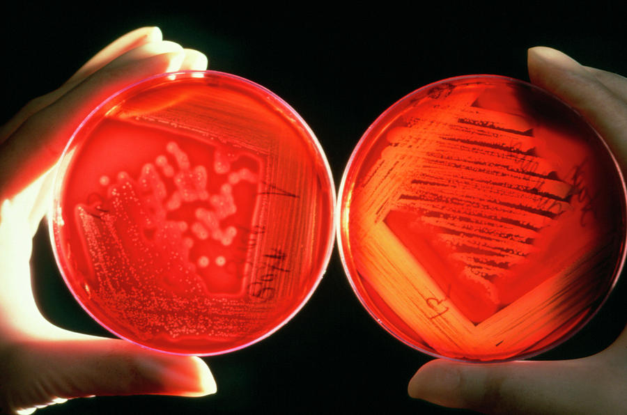 Hands Holding Petri Dishes With Cultures Photograph by National Cancer Institute/science Photo Library
