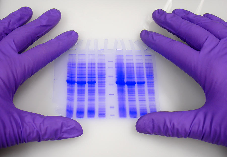 Hands in protective gloves hold blue-stained electrophoresis gel. Photograph by Elkor