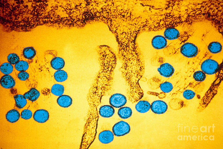 Medical Photograph - Hanta Virus Tem by Scott Camazine
