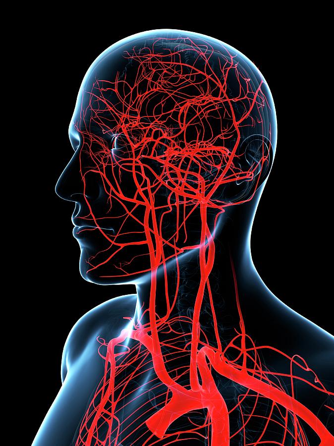 Head And Neck Arteries Photograph by Sciepro/science Photo Library ...