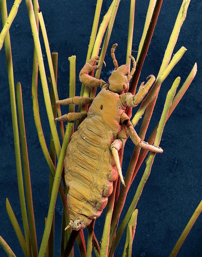 Head Lice Photograph by Eye of Science