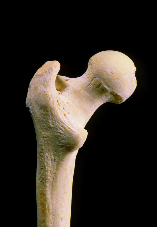 Head Of Human Femur (thigh Bone) Photograph by James Stevenson/science